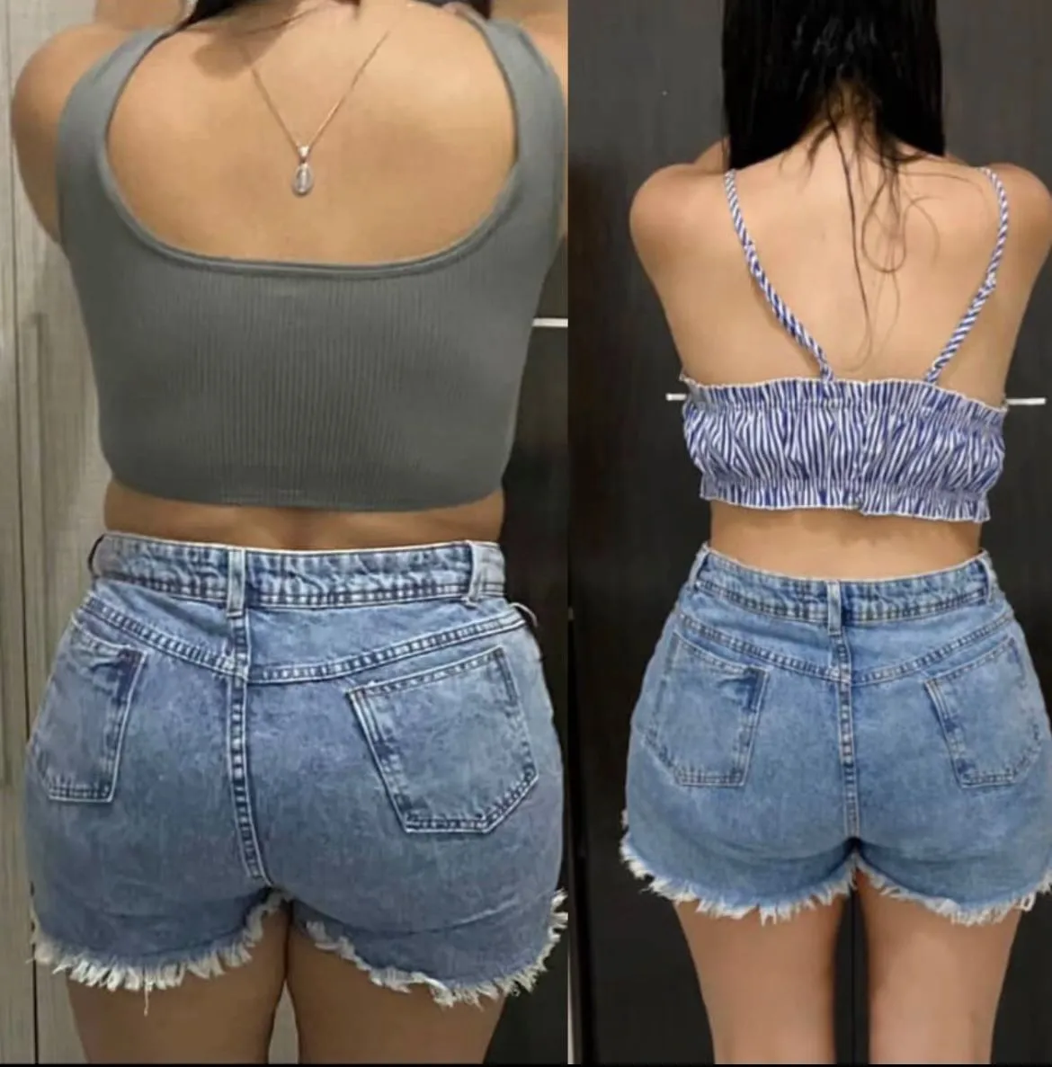 Resultado antes e depois de Valéria — 10kg perdidos com o Protocolo de Chás para Lipedema