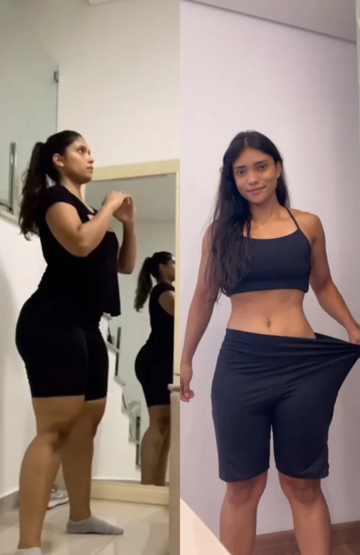 Antes e depois da Larissa Fiuza